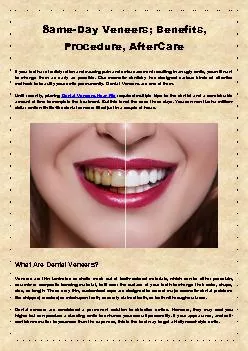 Same-Day Veneers; Benefits, Procedure, AfterCare