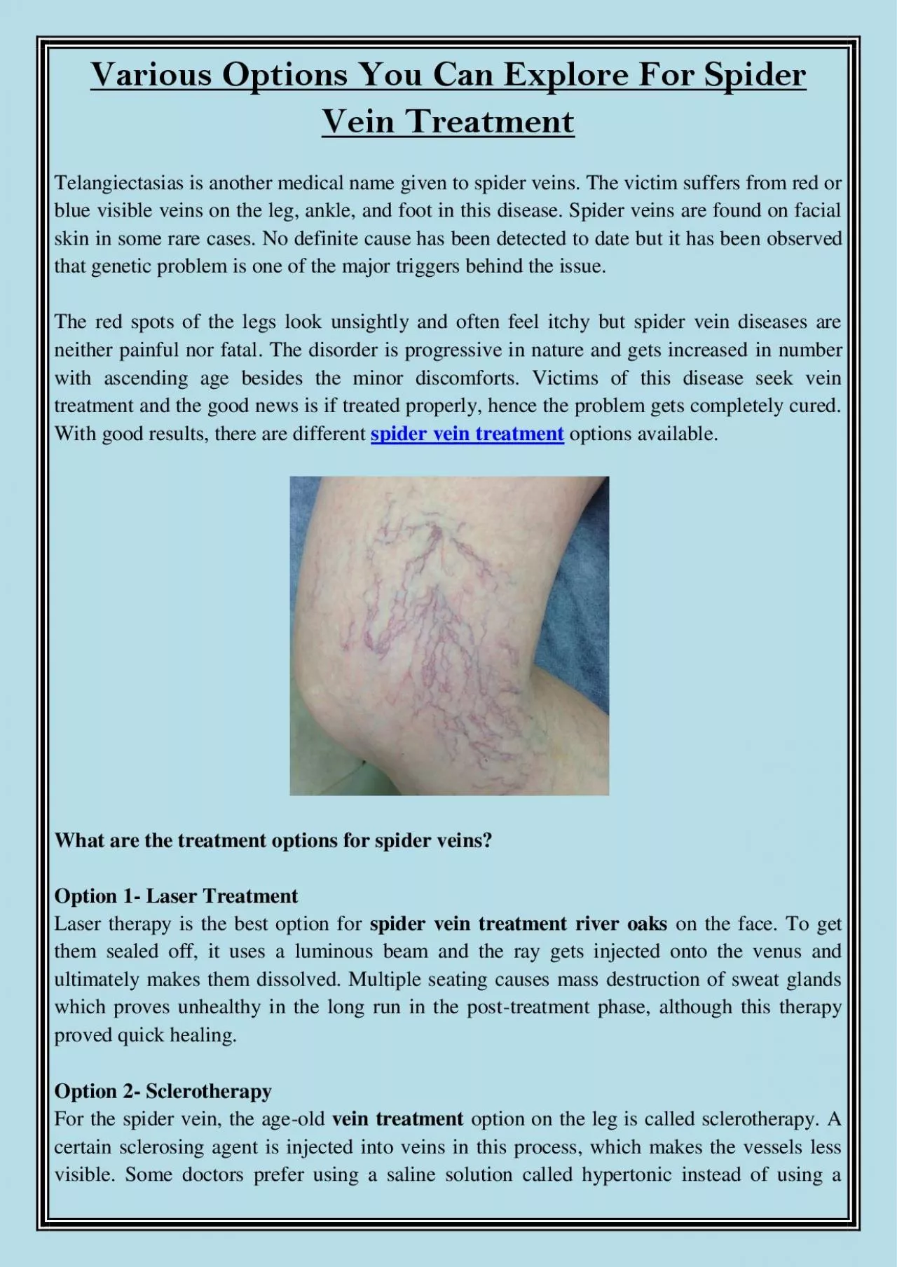 PDF-Various Options You Can Explore For Spider Vein Treatment