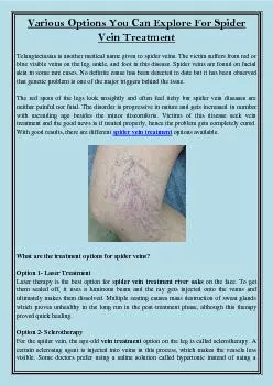 Various Options You Can Explore For Spider Vein Treatment