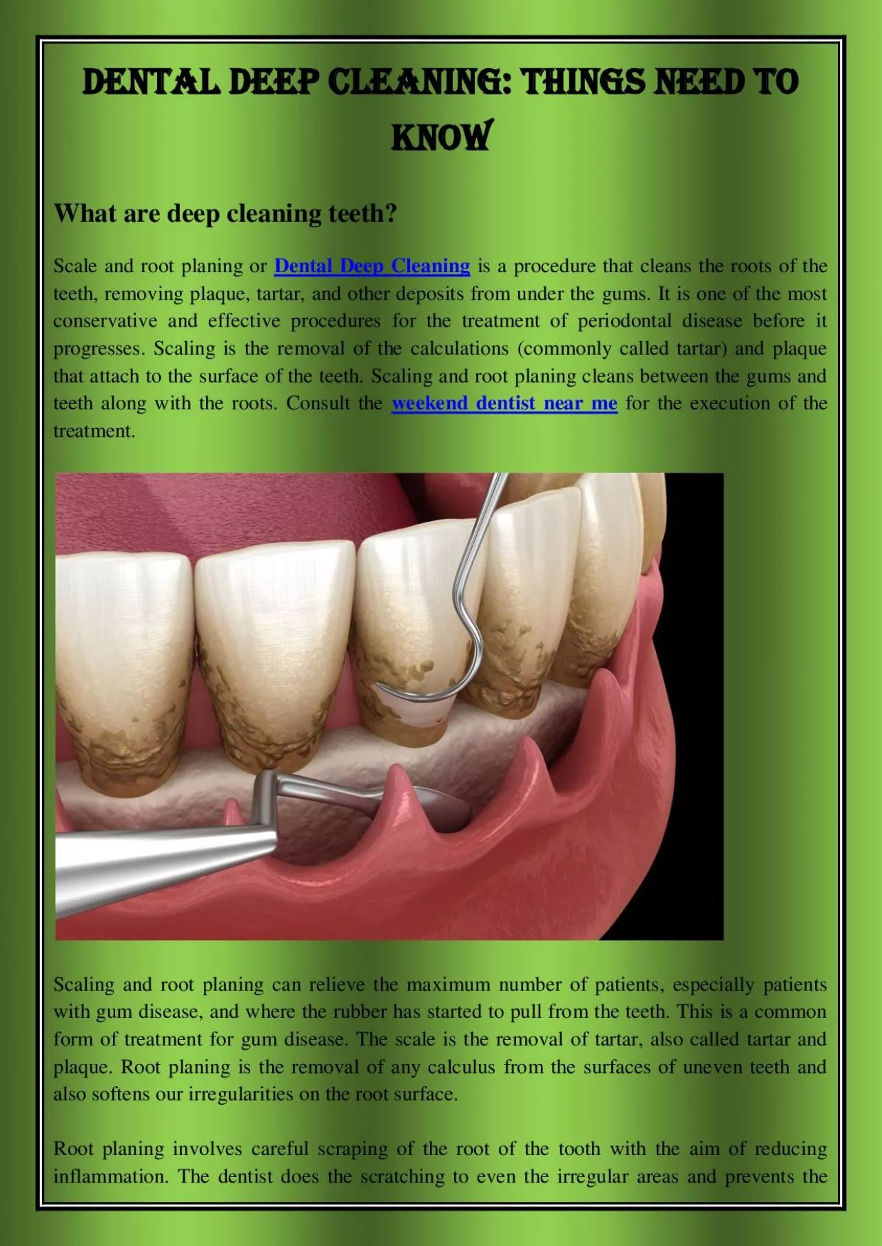 PDF-Dental Deep Cleaning Things Need To Know