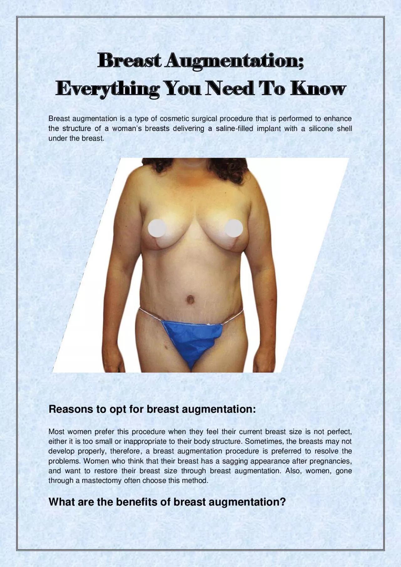 PDF-Breast Augmentation; Everything You Need To Know