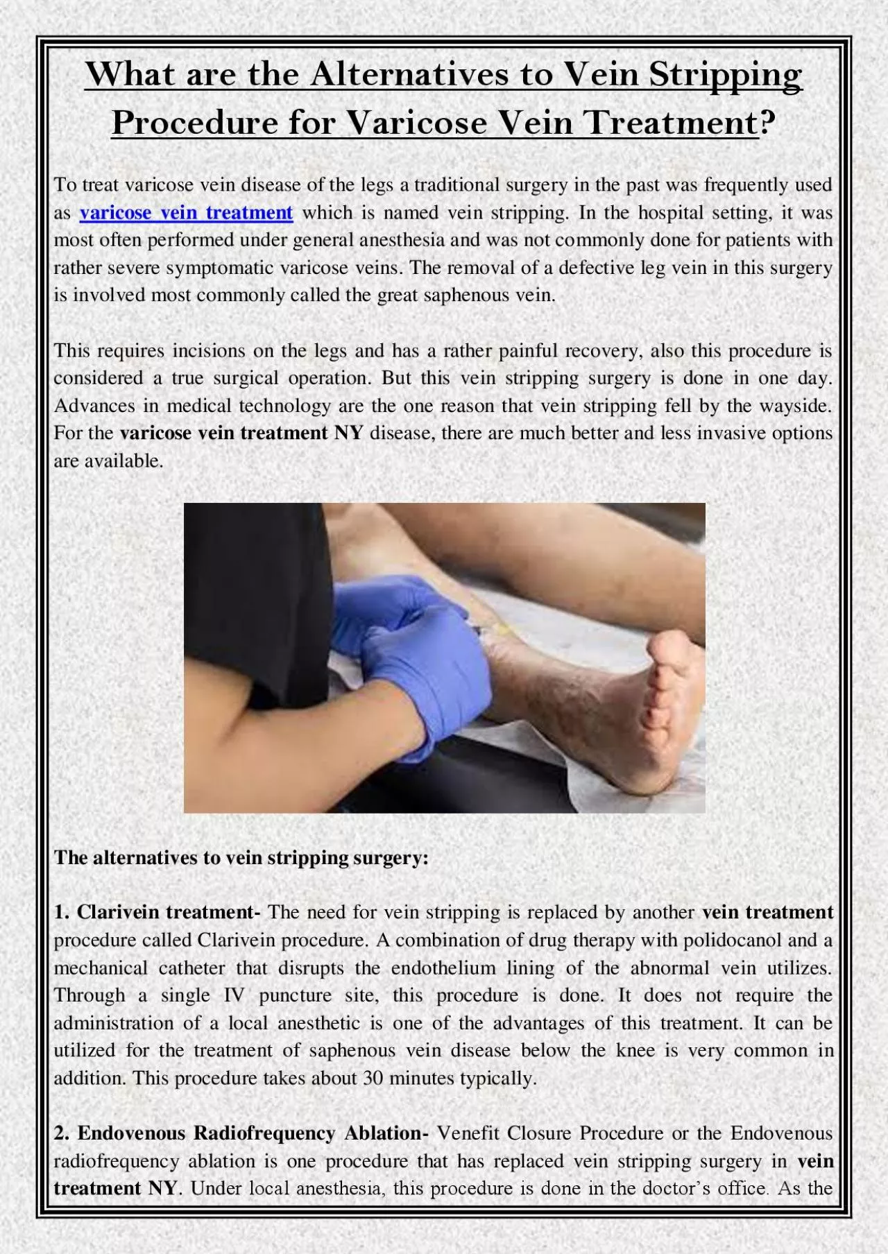 PDF-What are the Alternatives to Vein Stripping Procedure for Varicose Vein Treatment?