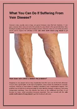 What You Can Do If Suffering From Vein Disease?