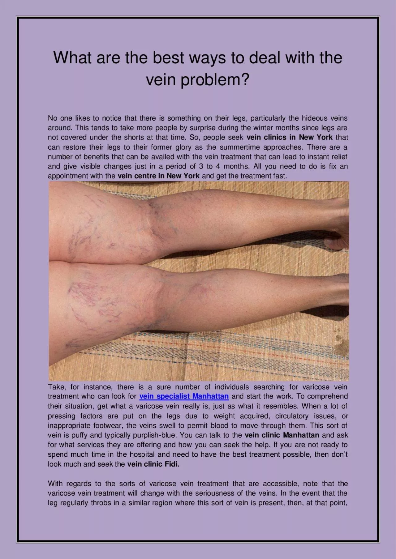 PDF-What are the best ways to deal with the vein problem?