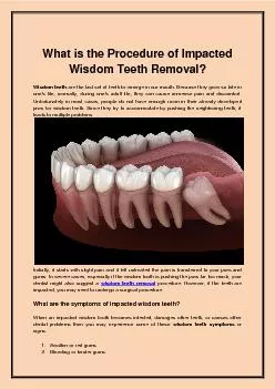 What is the Procedure of Impacted Wisdom Teeth Removal?