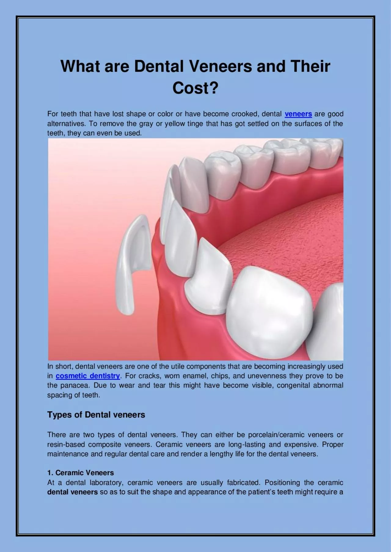 PDF-What are Dental Veneers and Their Cost?