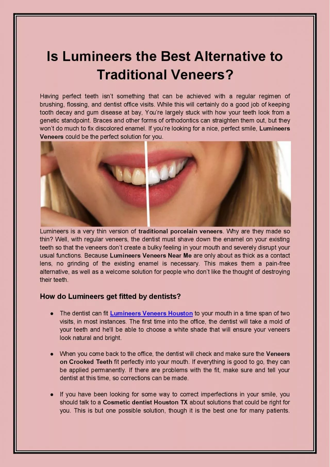 PDF-Is Lumineers the Best Alternative to Traditional Veneers?