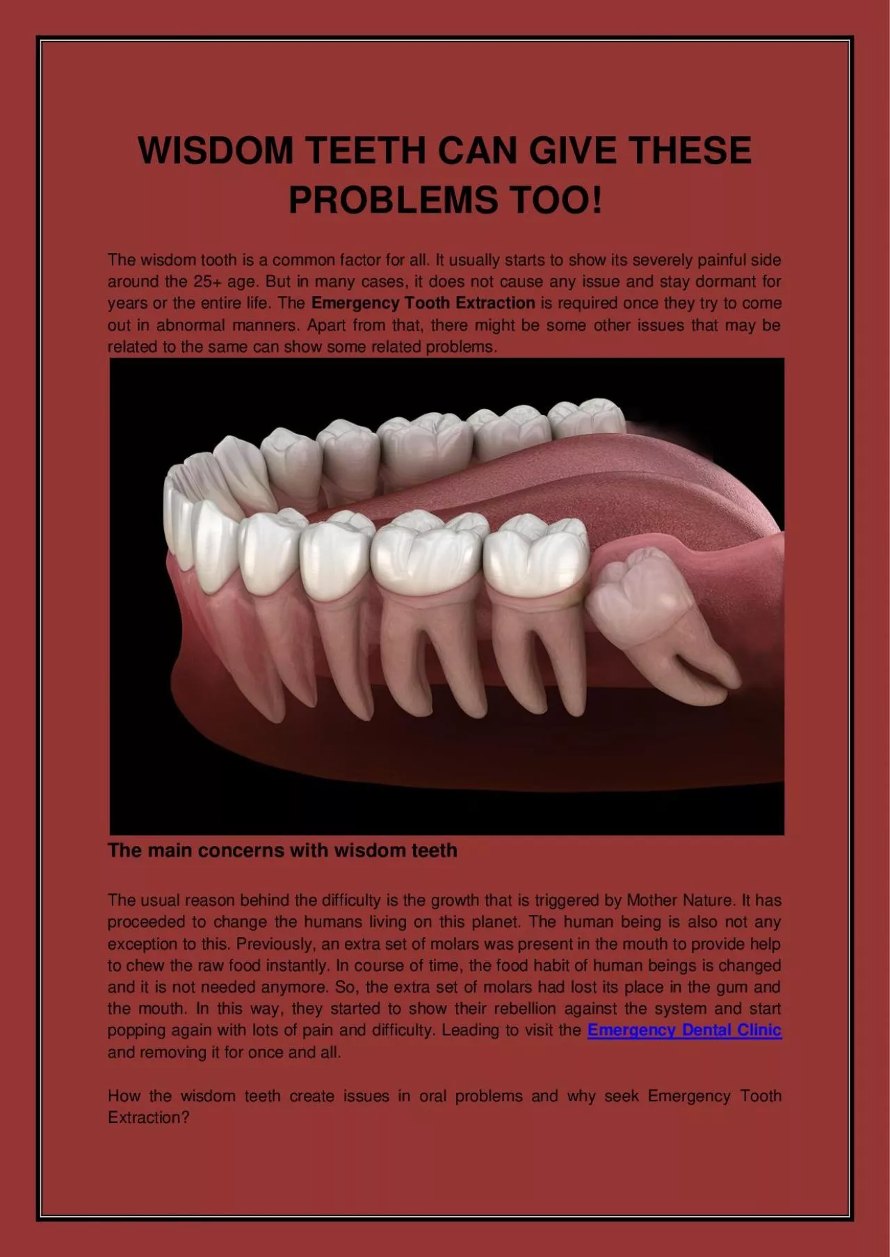 PDF-WISDOM TEETH CAN GIVE THESE PROBLEMS TOO!