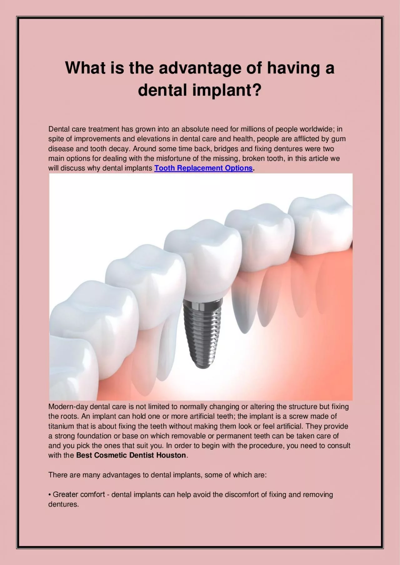 PDF-Everything You Need To Know About Dental Implants