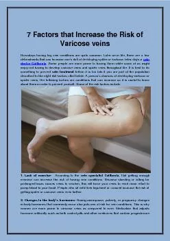7 Factors that Increase the Risk of Varicose veins