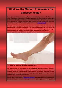 What are the Modern Treatments for Varicose Veins?