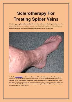 Sclerotherapy For Treating Spider Veins