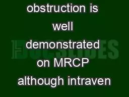 The site of obstruction is well demonstrated on MRCP although intraven