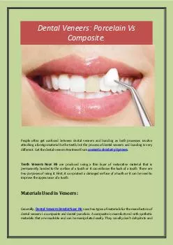 Dental Veneers: Porcelain Vs Composite