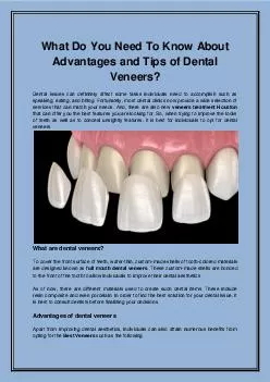 What Do You Need To Know About Advantages and Tips of Dental Veneers?