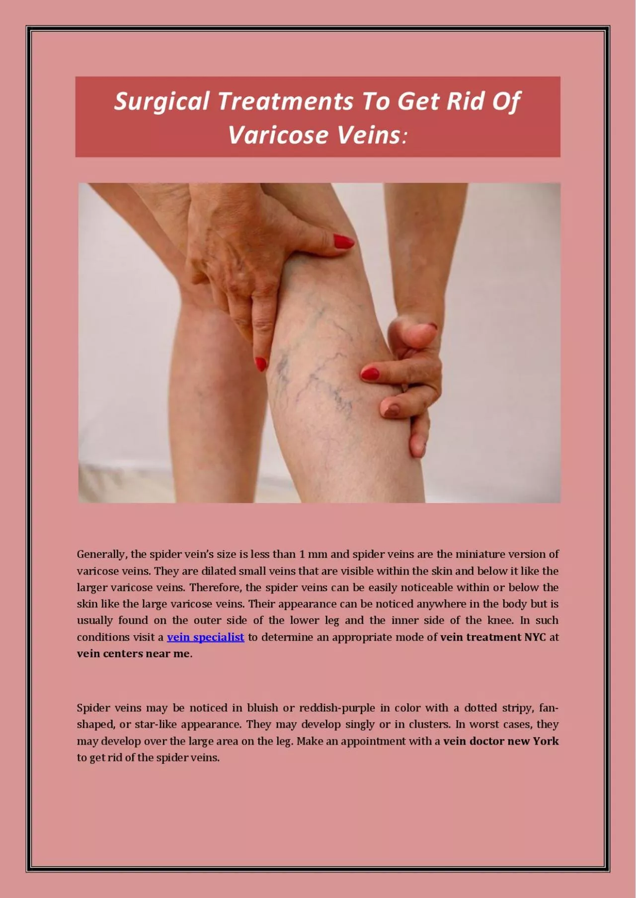 PDF-Surgical Treatments To Get Rid Of Varicose Veins: