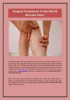 Surgical Treatments To Get Rid Of Varicose Veins: