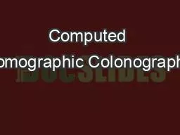 Computed Tomographic Colonography