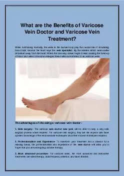 What are the Benefits of Varicose Vein Doctor and Varicose Vein Treatment?