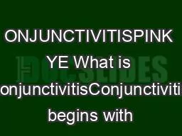ONJUNCTIVITISPINK YE What is ConjunctivitisConjunctivitis begins with