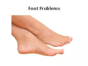 Foot Problems