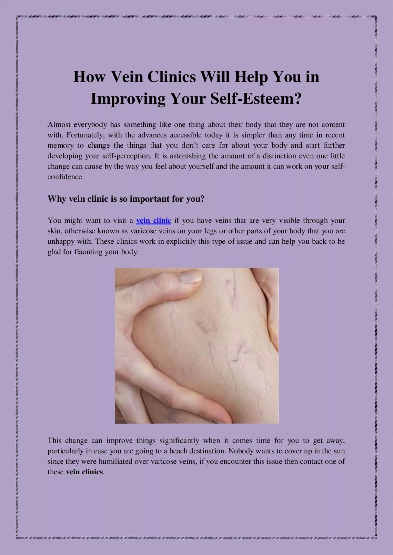 PDF-How Vein Clinics Will Help You in Improving Your Self-Esteem?