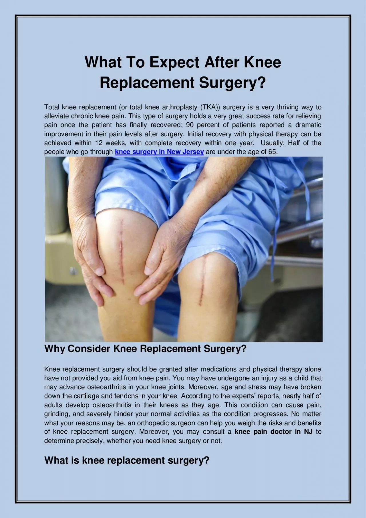 PDF-What To Expect After Knee Replacement Surgery?