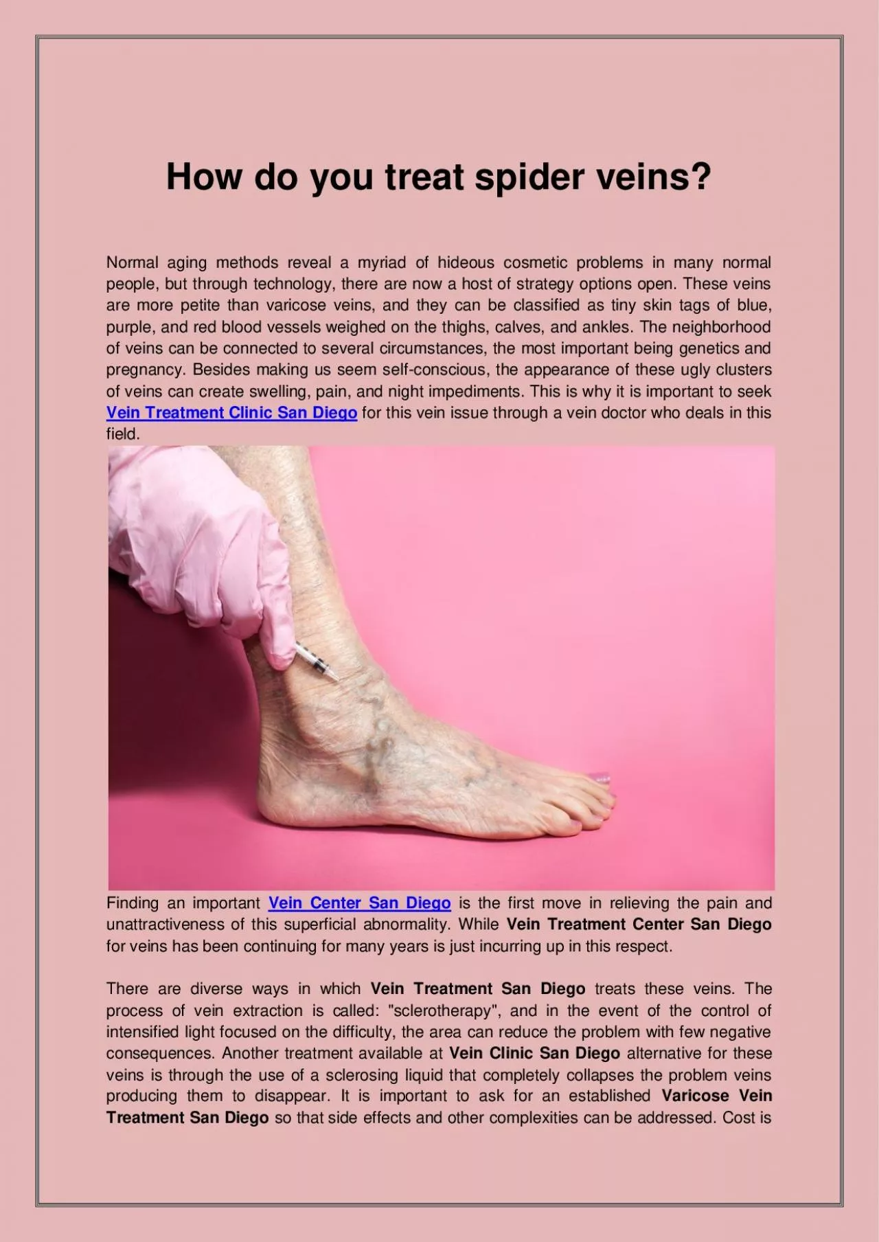 PDF-How do you treat spider veins?