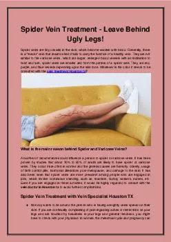 Spider Vein Treatment - Leave Behind Ugly Legs!