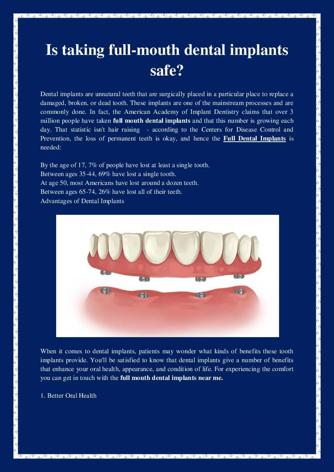 PDF-Is taking full-mouth dental implants safe?