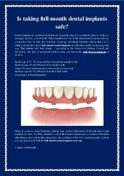 Is taking full-mouth dental implants safe?