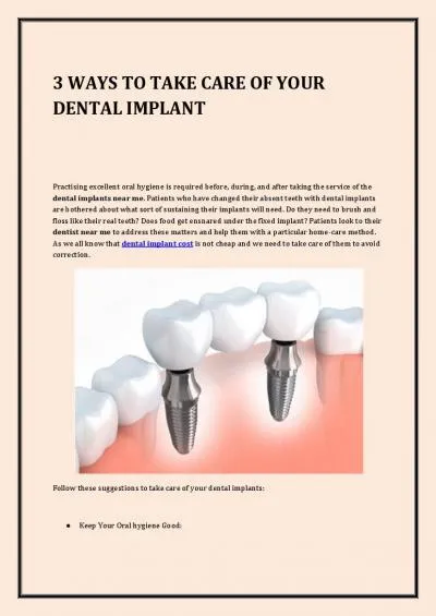 3 WAYS TO TAKE CARE OF YOUR DENTAL IMPLANT