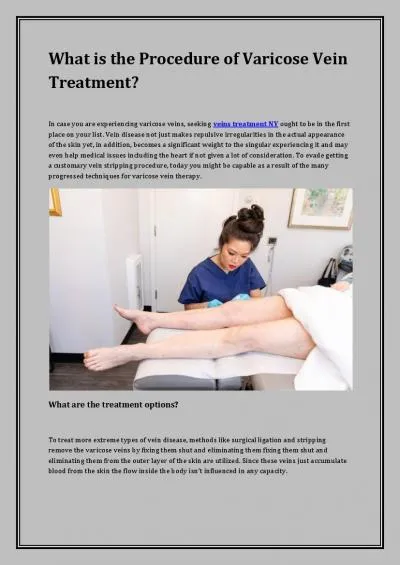 What is the Procedure of Varicose Vein Treatment