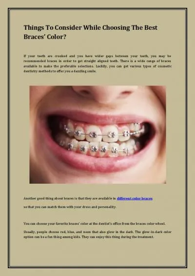 Things To Consider While Choosing The Best Braces’ Color