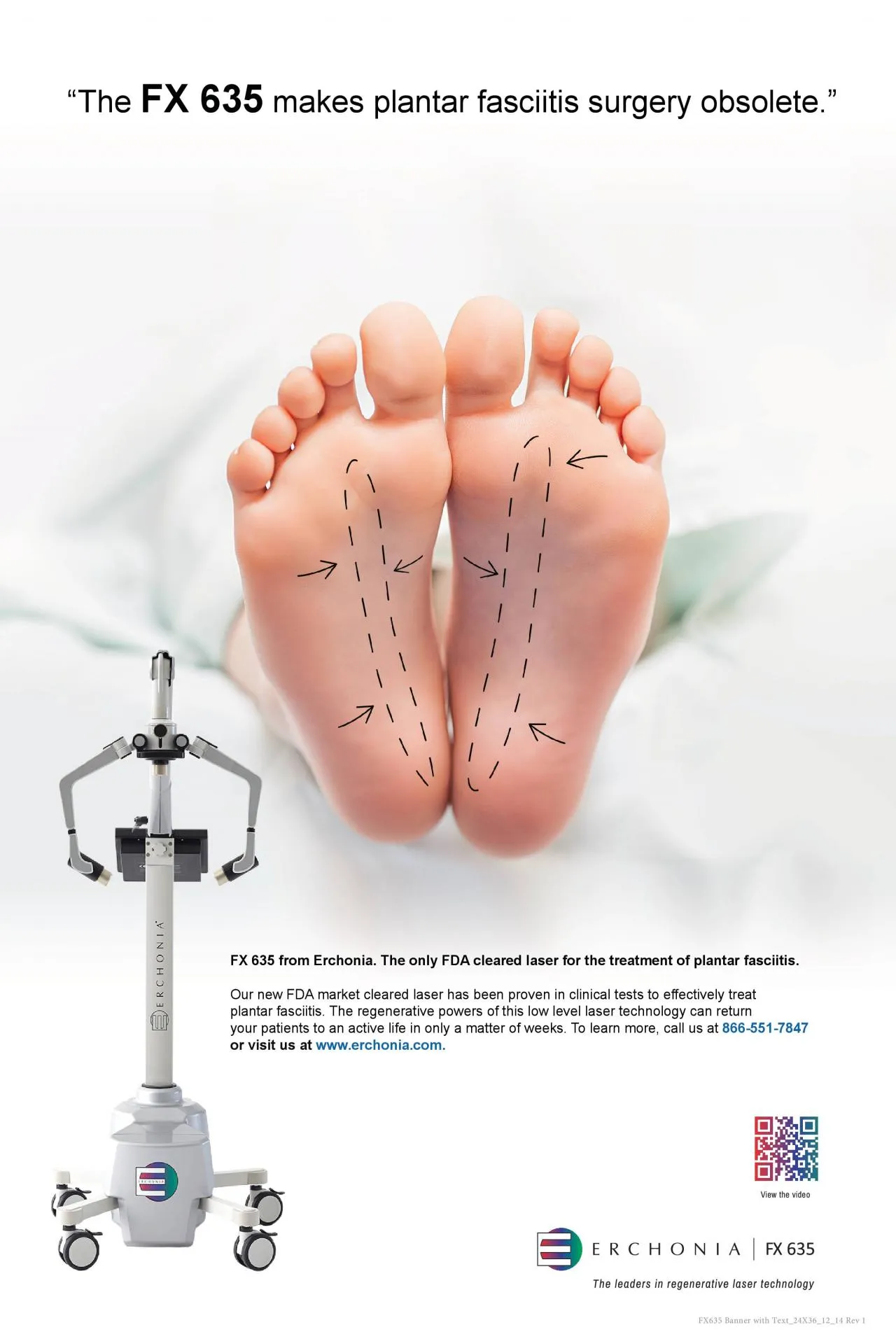 PDF-FX 635 from Erchonia The only FDA cleared laser for the treatment of p