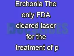 FX 635 from Erchonia The only FDA cleared laser for the treatment of p