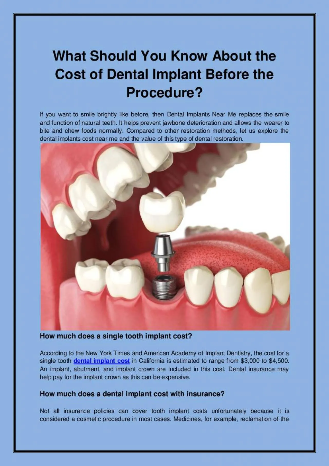 PDF-What Should You Know About the Cost of Dental Implant Before the Procedure