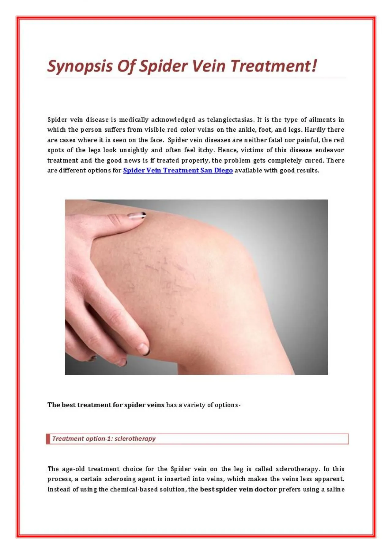 PDF-Synopsis Of Spider Vein Treatment!