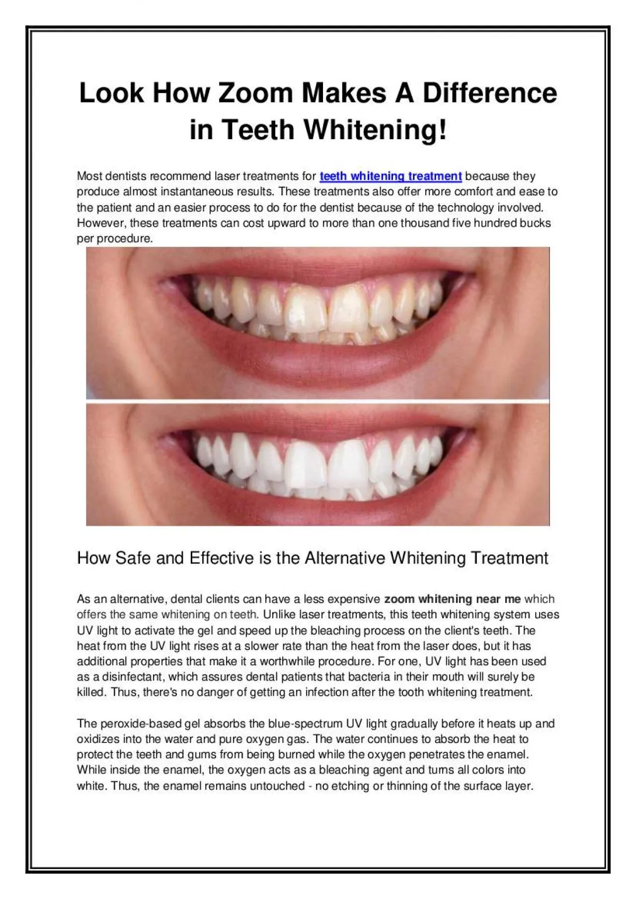 PDF-Look How Zoom Makes A Difference in Teeth Whitening