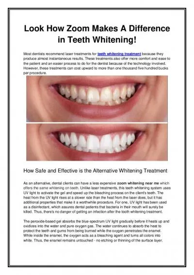 Look How Zoom Makes A Difference in Teeth Whitening