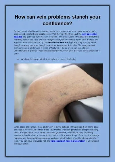 How can vein problems stanch your confidence