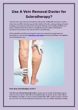 Use A Vein Removal Doctor for Sclerotherapy