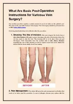 What Are Basic Post Operative Instructions for Varicose Vein Surgery