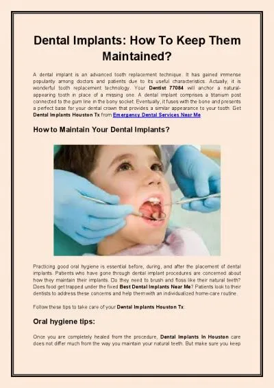 Dental Implants How To Keep Them Maintained