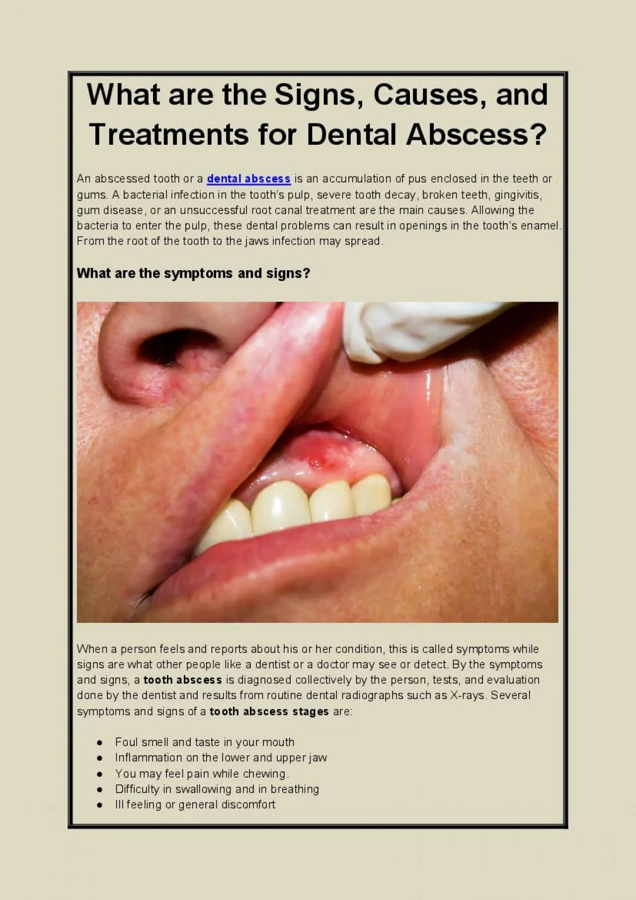 PDF-What are the Signs, Causes, and Treatments for Dental Abscess