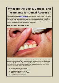 What are the Signs, Causes, and Treatments for Dental Abscess