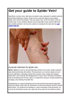 Get your guide to Spider Vein