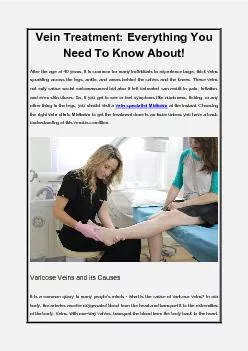 Vein Treatment Everything You Need To Know About