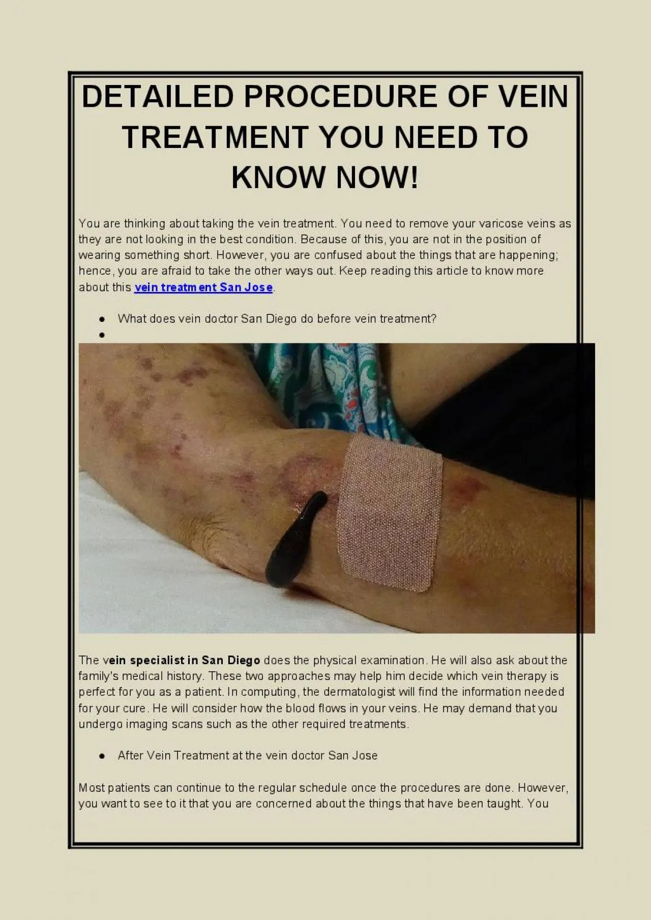 PDF-DETAILED PROCEDURE OF VEIN TREATMENT YOU NEED TO KNOW NOW