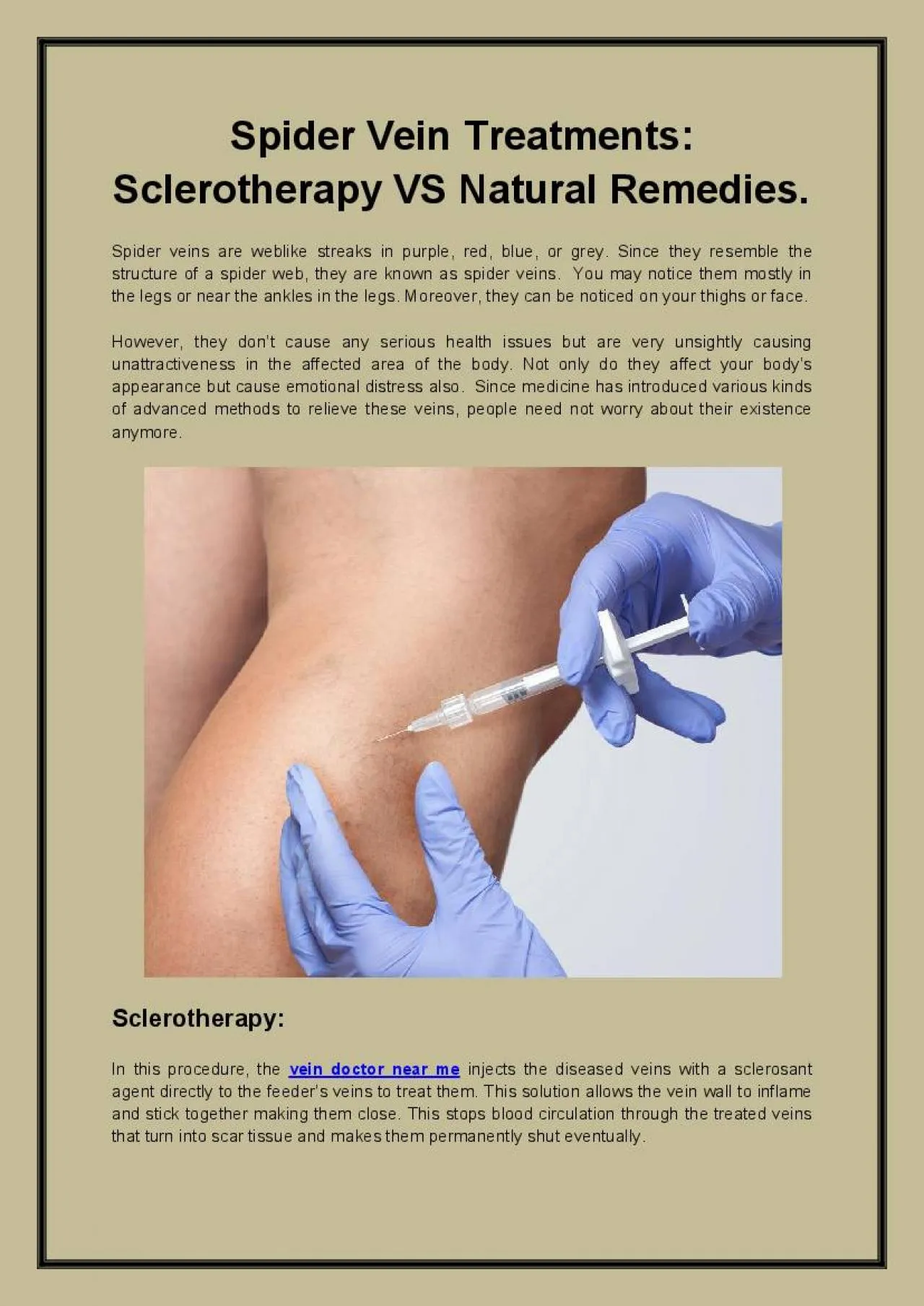 PDF-Spider Vein Treatments Sclerotherapy VS Natural Remedies